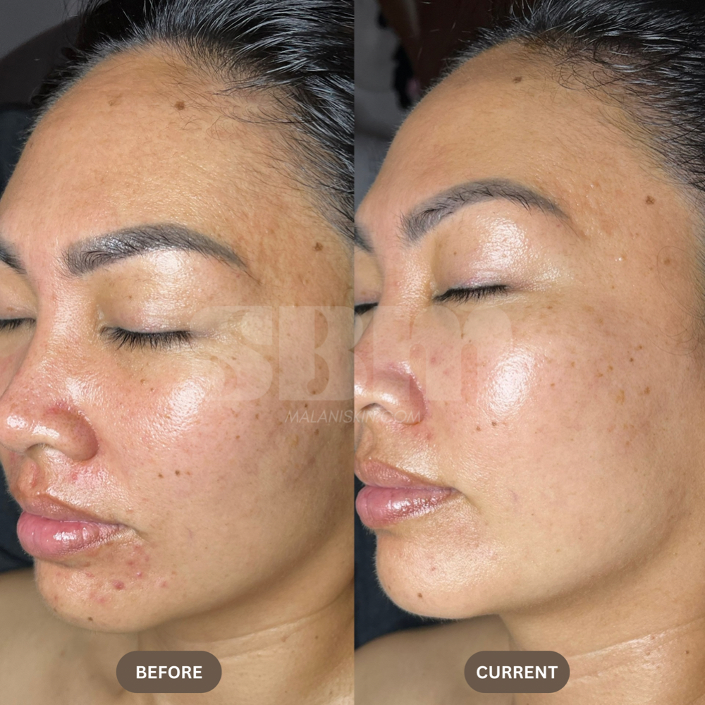 Maintenance Custom Facial