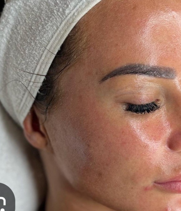 Tox Facial For Glass Look at Skin & Toxx in Houston, TX