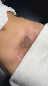 Brazilian Wax