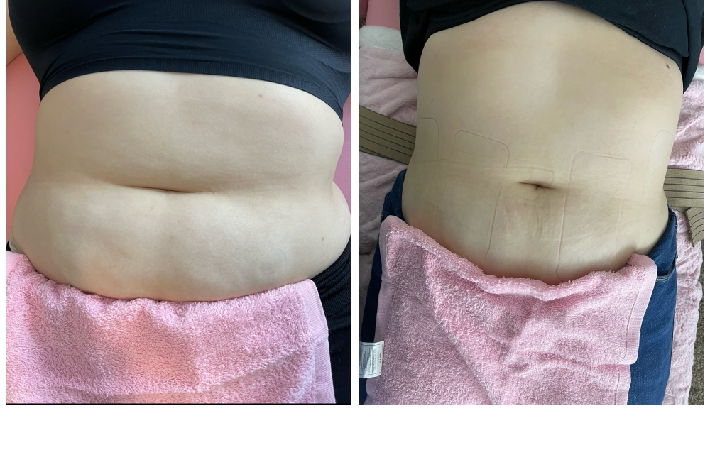 body sculpt 360