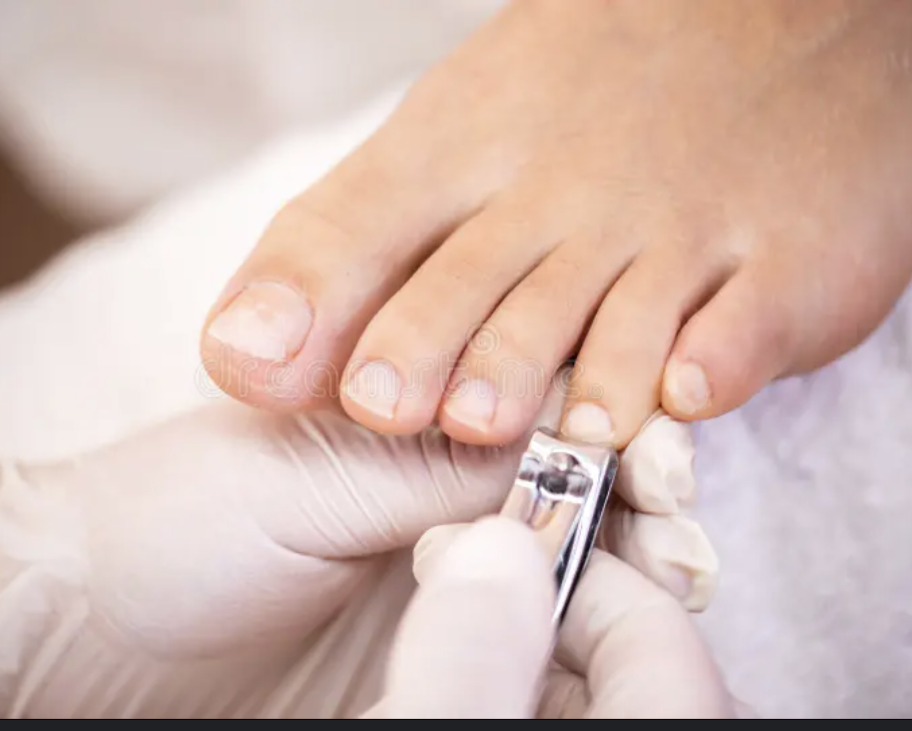 Toenail Trim