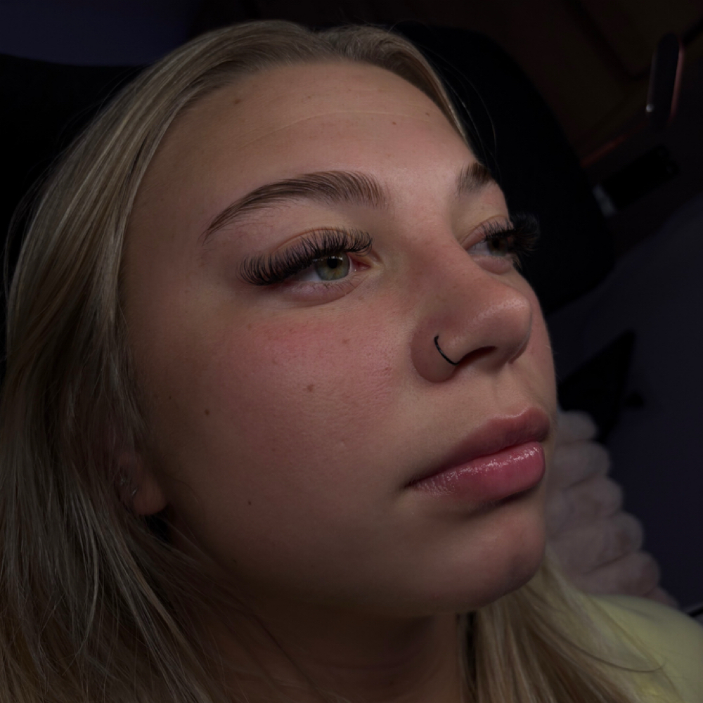 2 Week Classic Fairy Fill at C Beauty Bar Aesthetic in Abilene, TX