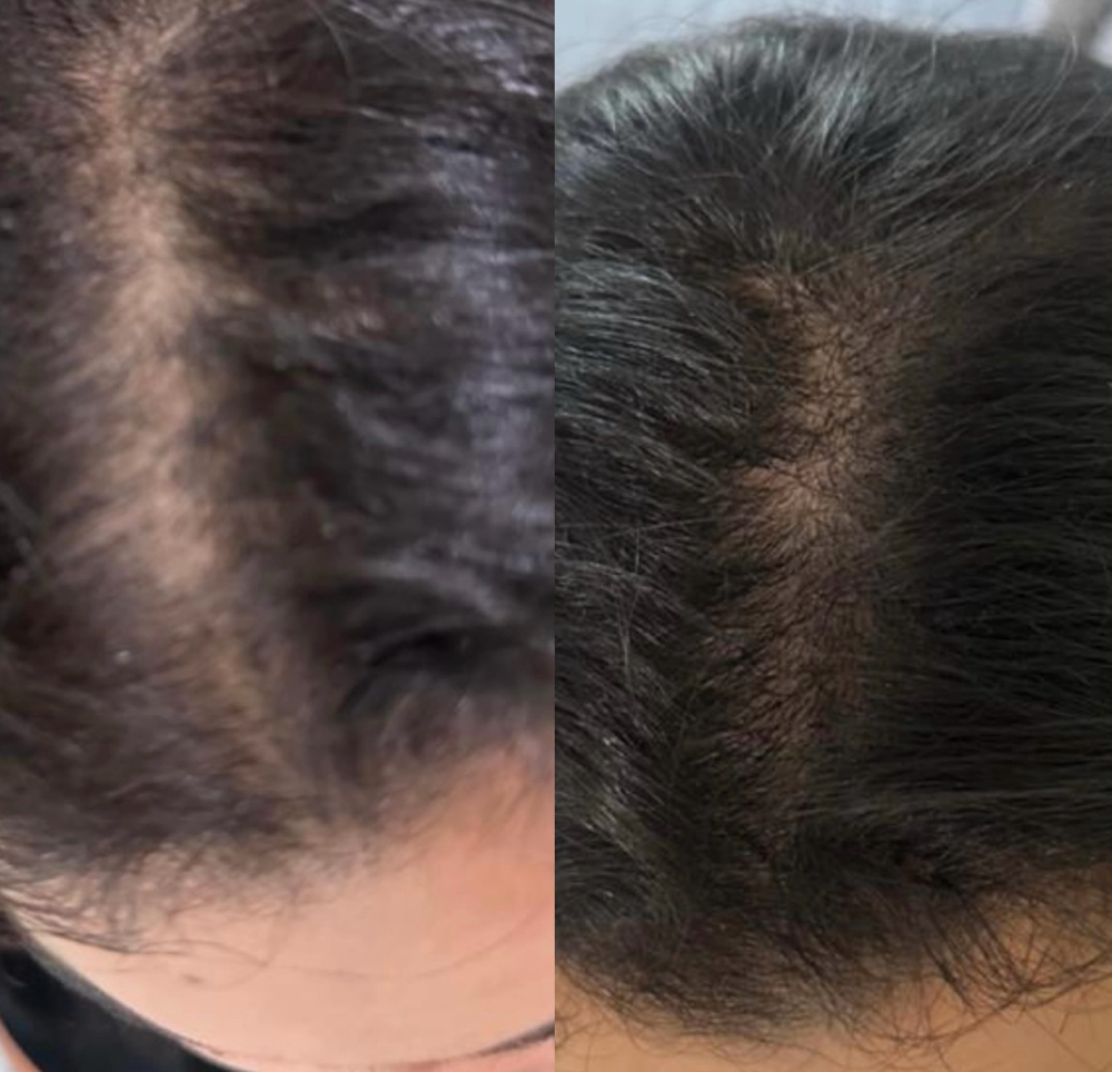 Tratamento Glow Hair (3 Sessões)