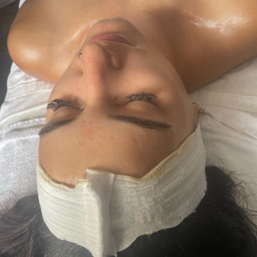 Chemical Peels at The Wax Palace in Buffalo, NY