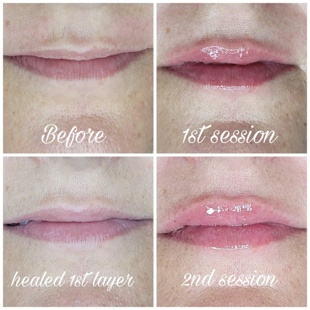 Hydra Lip Infusion