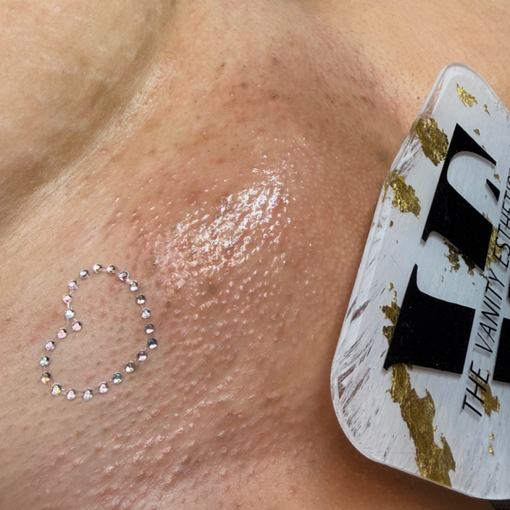 upgraded brazilian wax