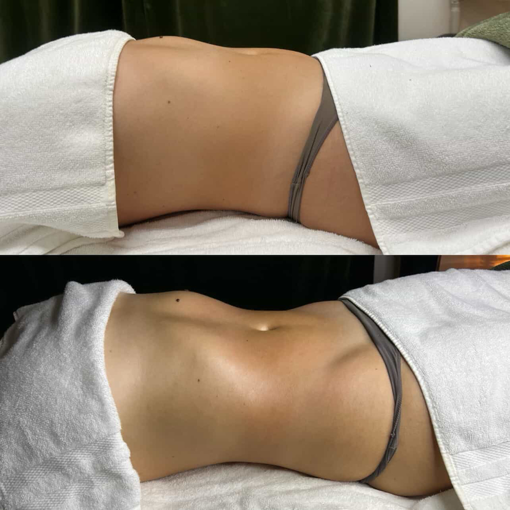 Brazilian Lymphatic Drainage at Unique Bodies by Monique in Casa Grande, AZ
