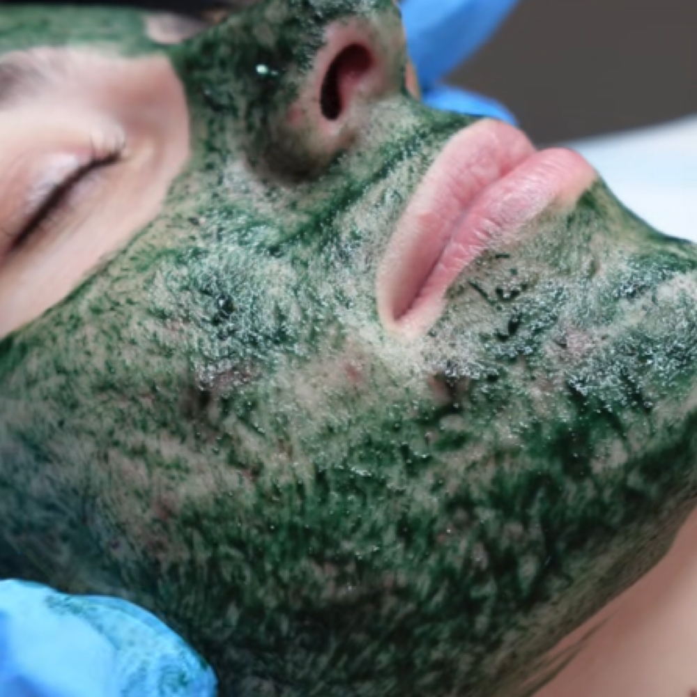 Green Sea Peel at Beautifully Esthetics in Costa Mesa, CA