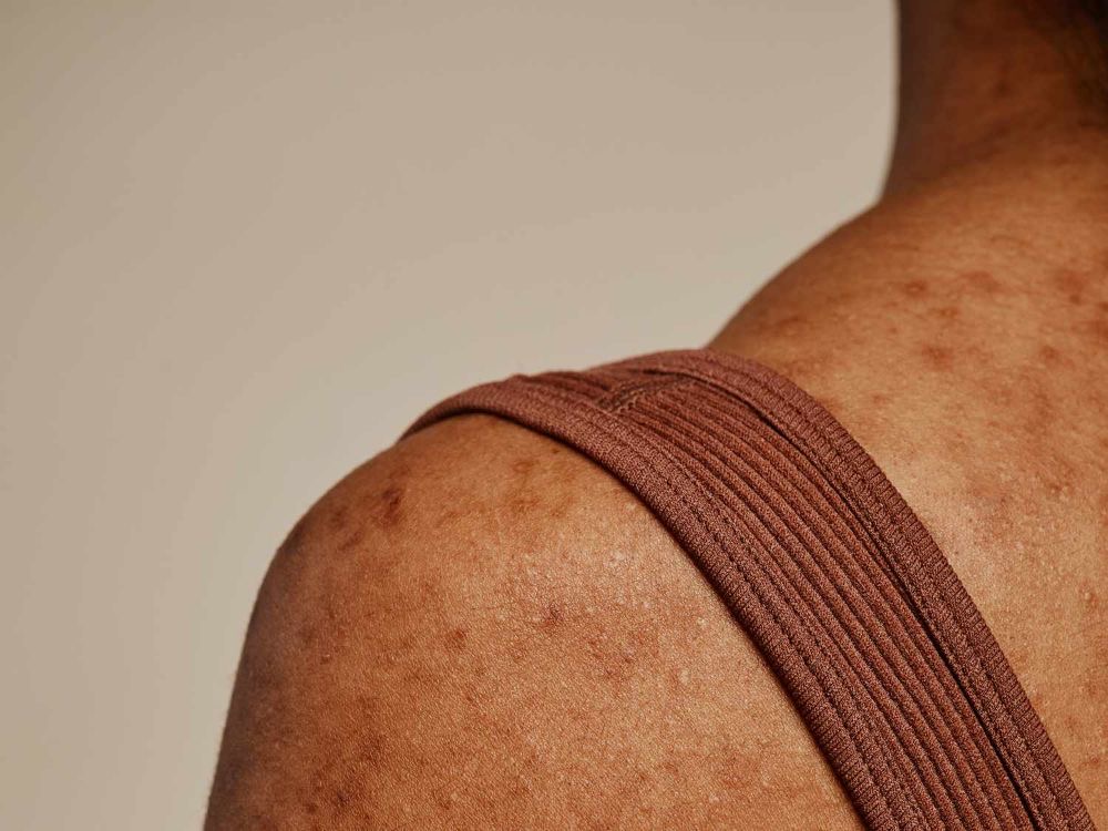 The Body Peel