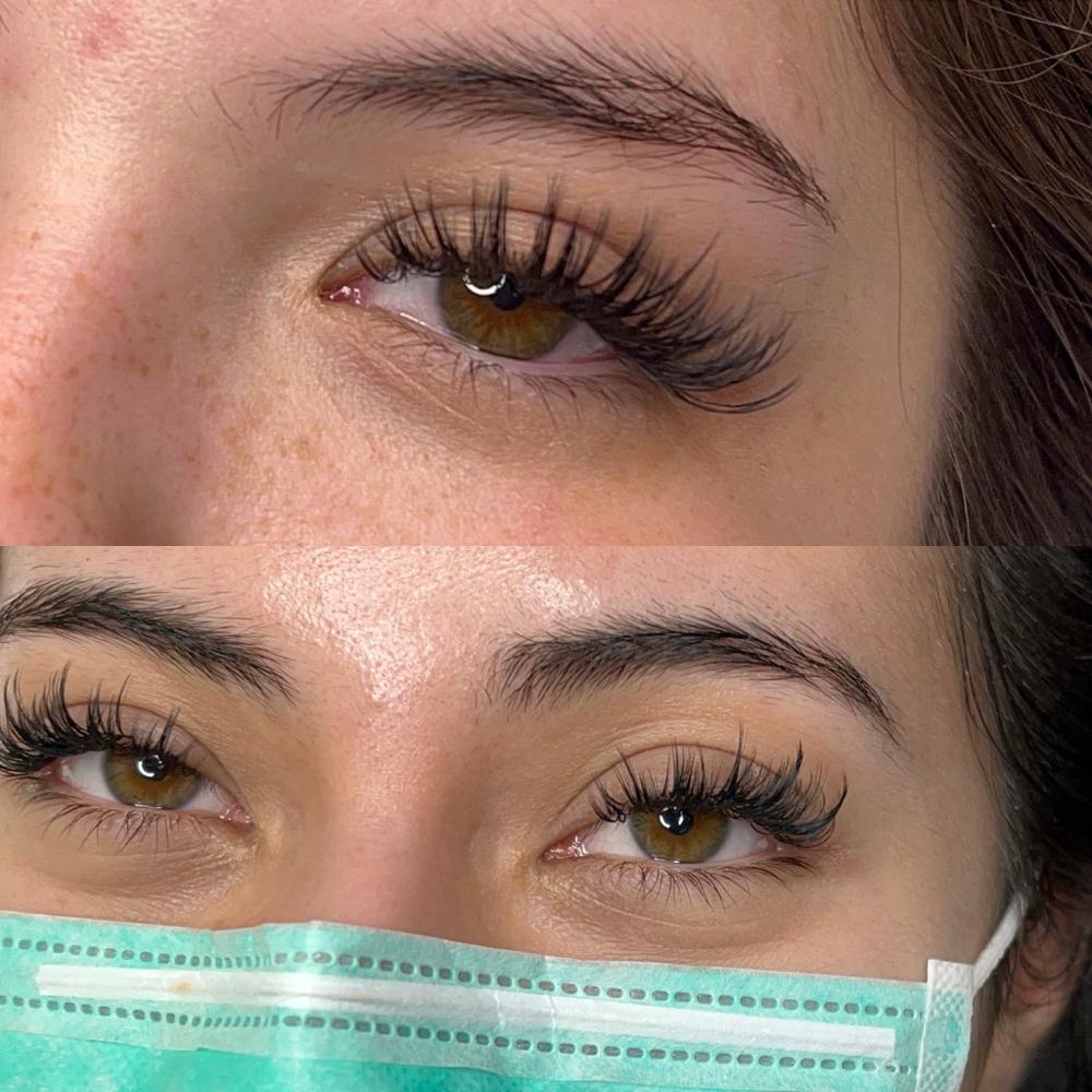 2-3 Week Angel Fill