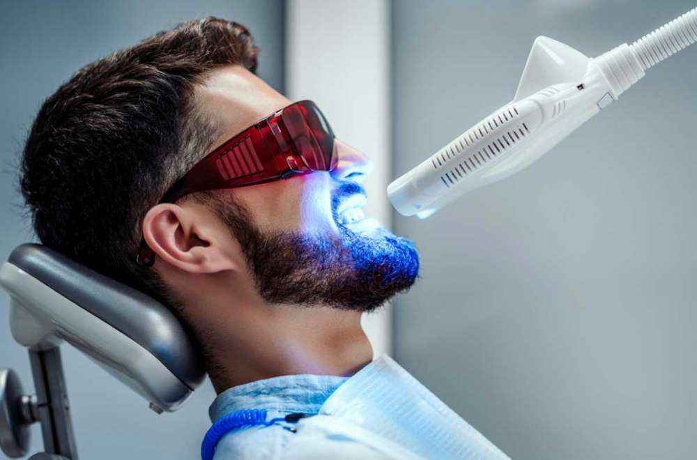 Teeth Whitening Bundle (2 Sessions)