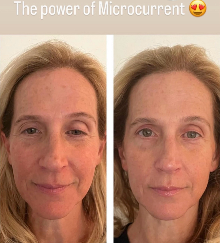 Anti-Aging Facial