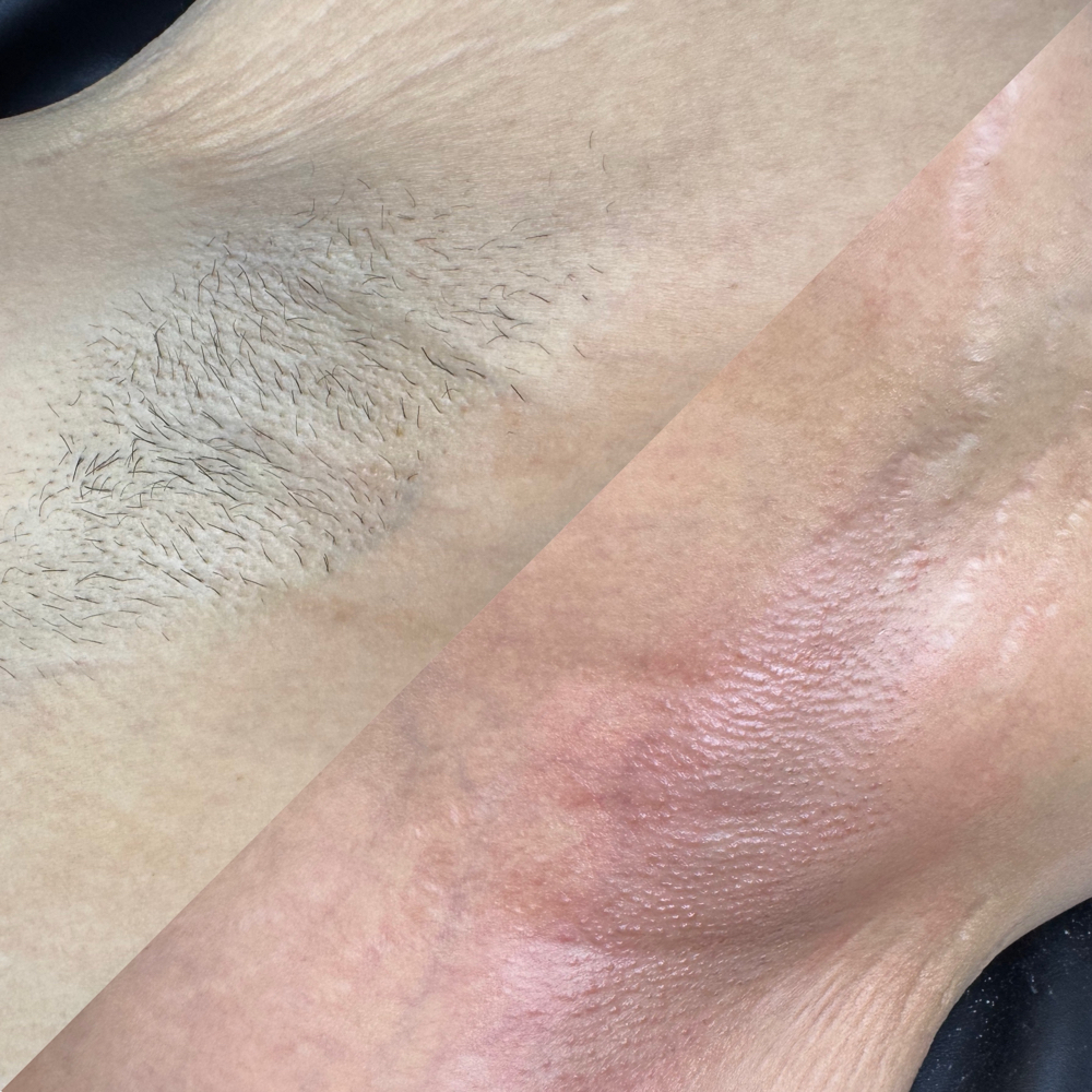 Body Waxing