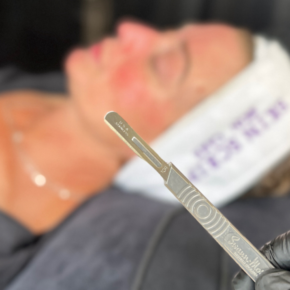 Dermaplane Facial 60 Minutes at Platinum Beauty Esthetics in Rocklin, CA