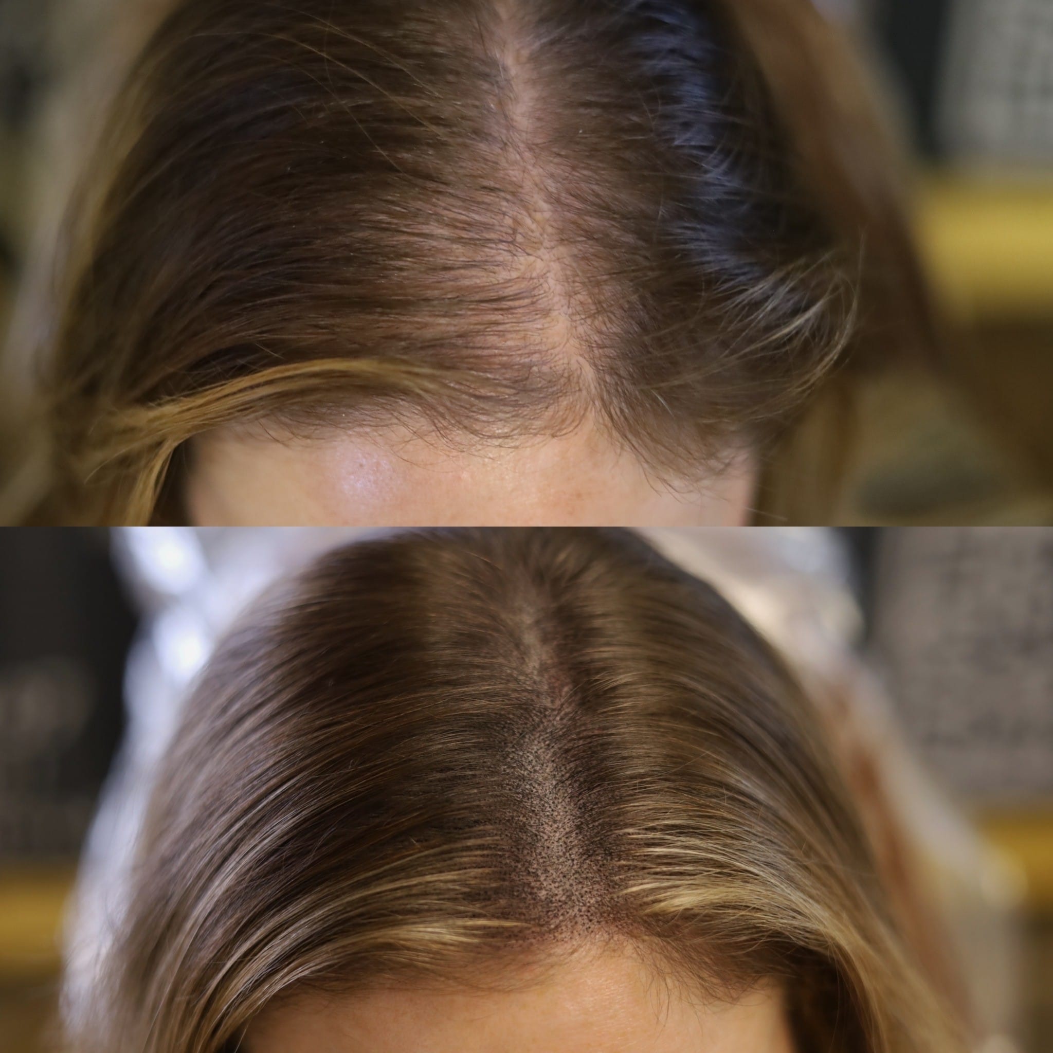 Scalp Micropigmentation at Black Heart Ink and Aesthetics in Myrtle Beach, SC