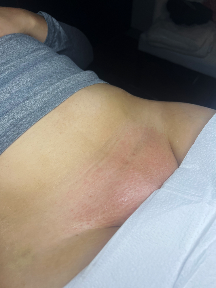 Full Brazilian 1st Time Or 6+weeks