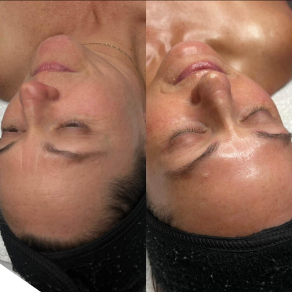 Luxe Lift Facial at Bare Beauty By Alexis in Bay Saint Louis, MS