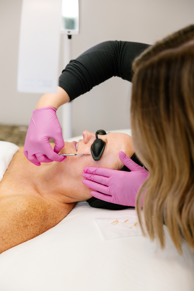 BSE Express Dermaplane Treatment at Bare Skin Esthetics in Leawood, KS