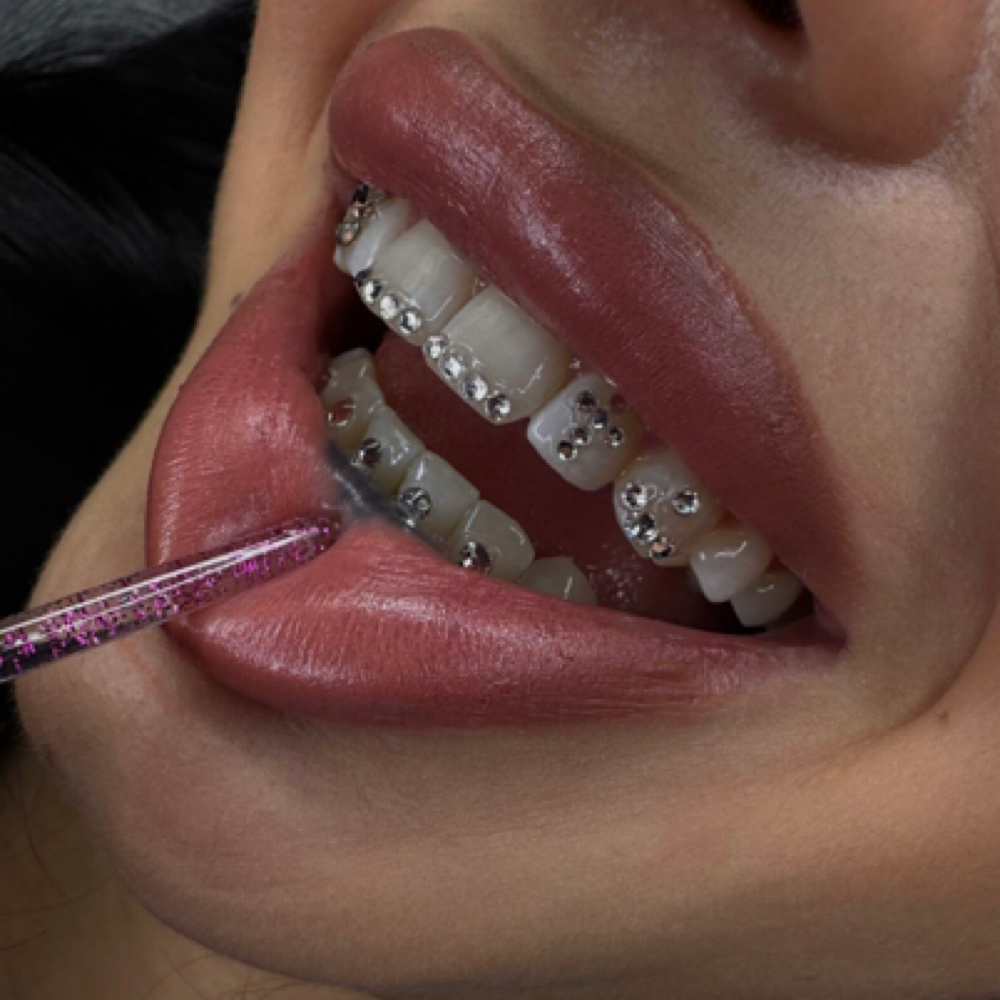 Tooth Gems at Chicabeauty.bar in Louisville, KY