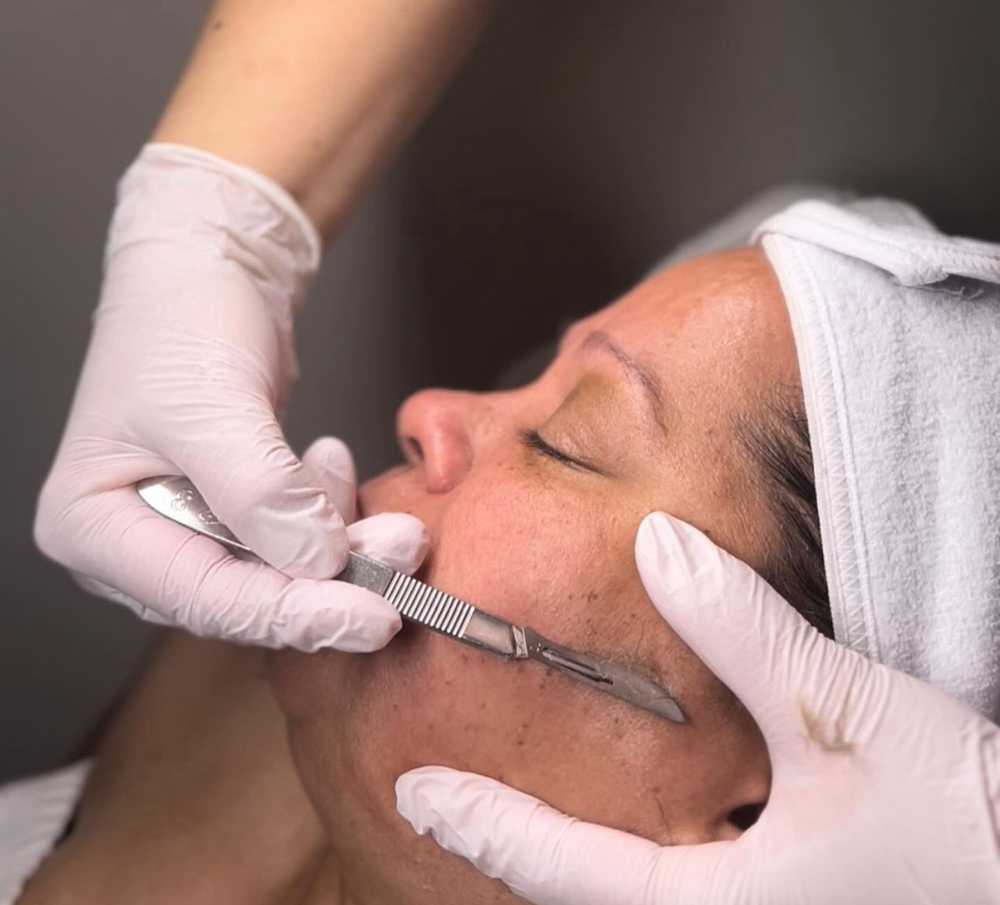 DERMAPLAINING at Mily Gerig Skincare Glow LLC in Lincoln, RI