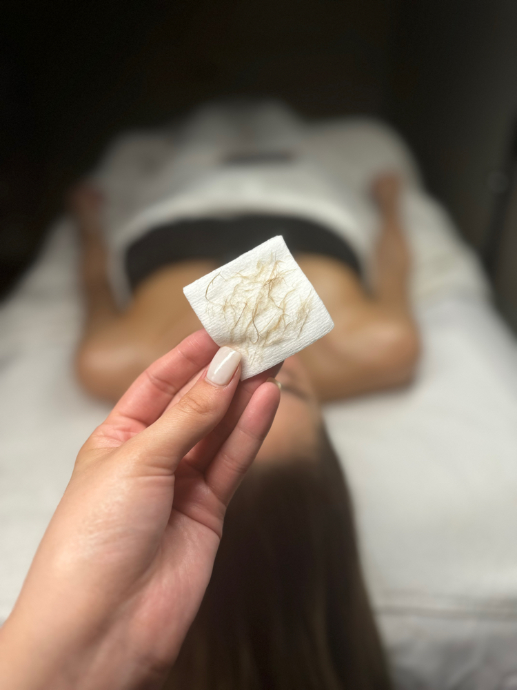 Dermaplane Facial