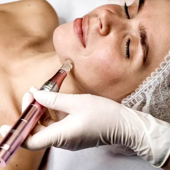 Peeling at Studio Chic Nail Salon and Spa in palmdale, CA