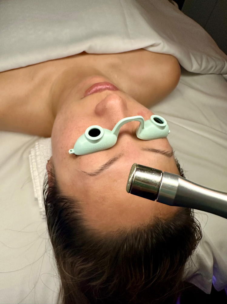 Microdermabrasion Treatment