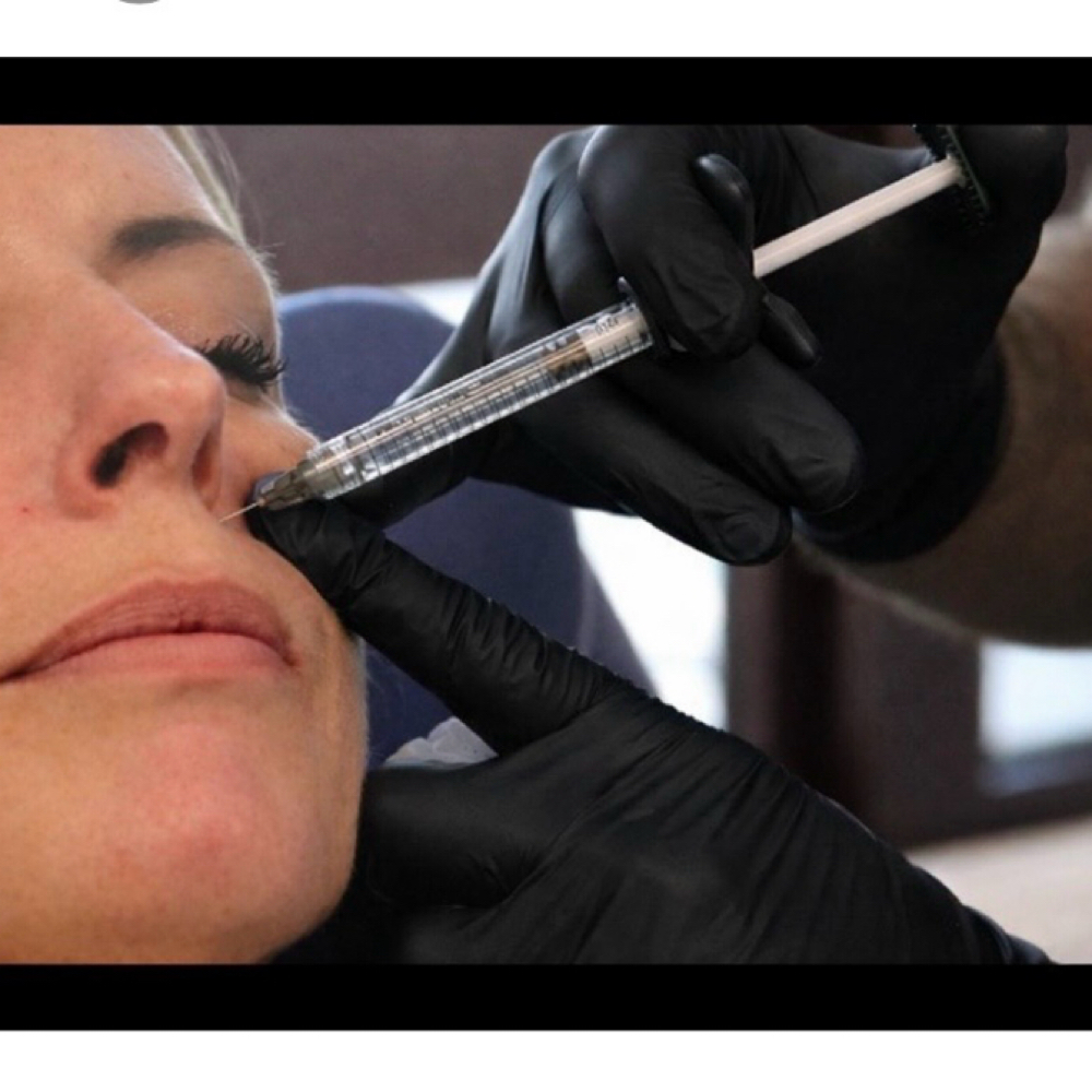 Radiesse at Stone Cosmetic Solutions in Ponca City, OK