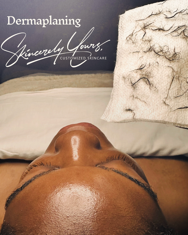 Dermaplaning