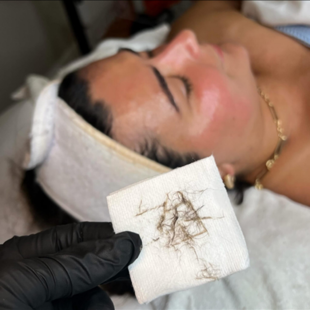 Dermaplane Facial at Bare Beauty By Alexis in Bay Saint Louis, MS