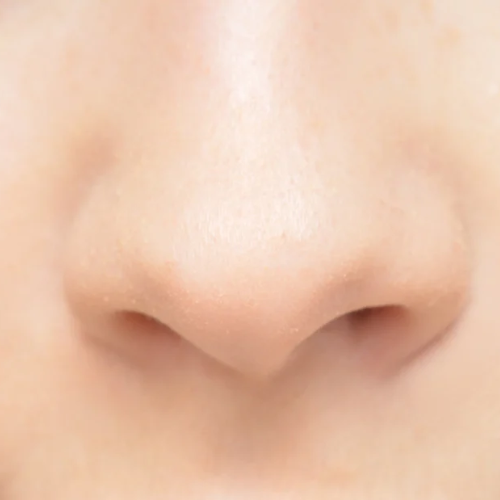 Nose