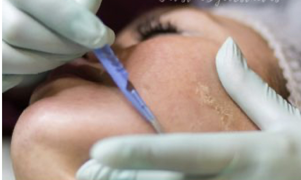 Deluxe Facial With Dermaplaning