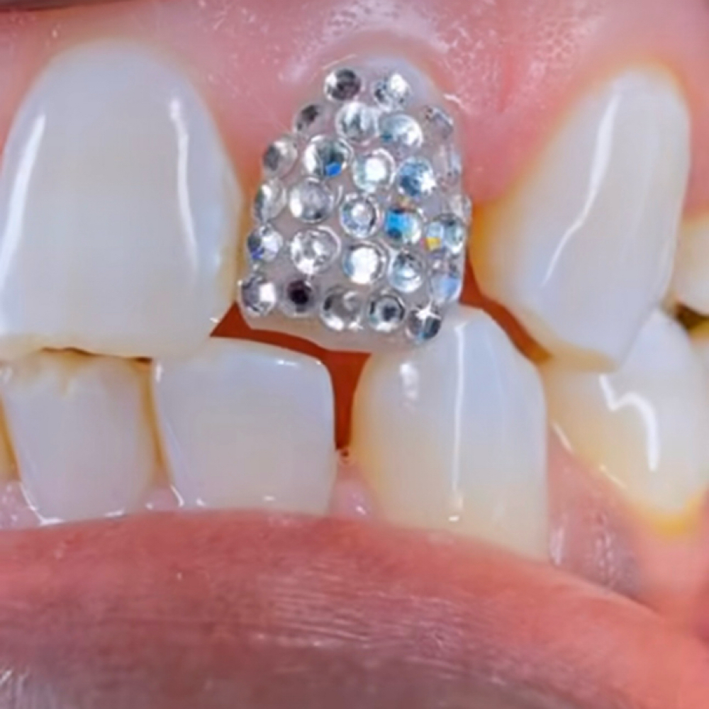 BOSS 🪩 BALLᴺᴶ at MONMOUTH COUNTYᴺᴶ ✧ 1ST TOOTH JEWELER ↯ #POPURWAXINCHERRY in Hazlet, NJ