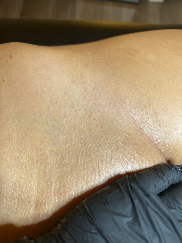 Brazilian Wax