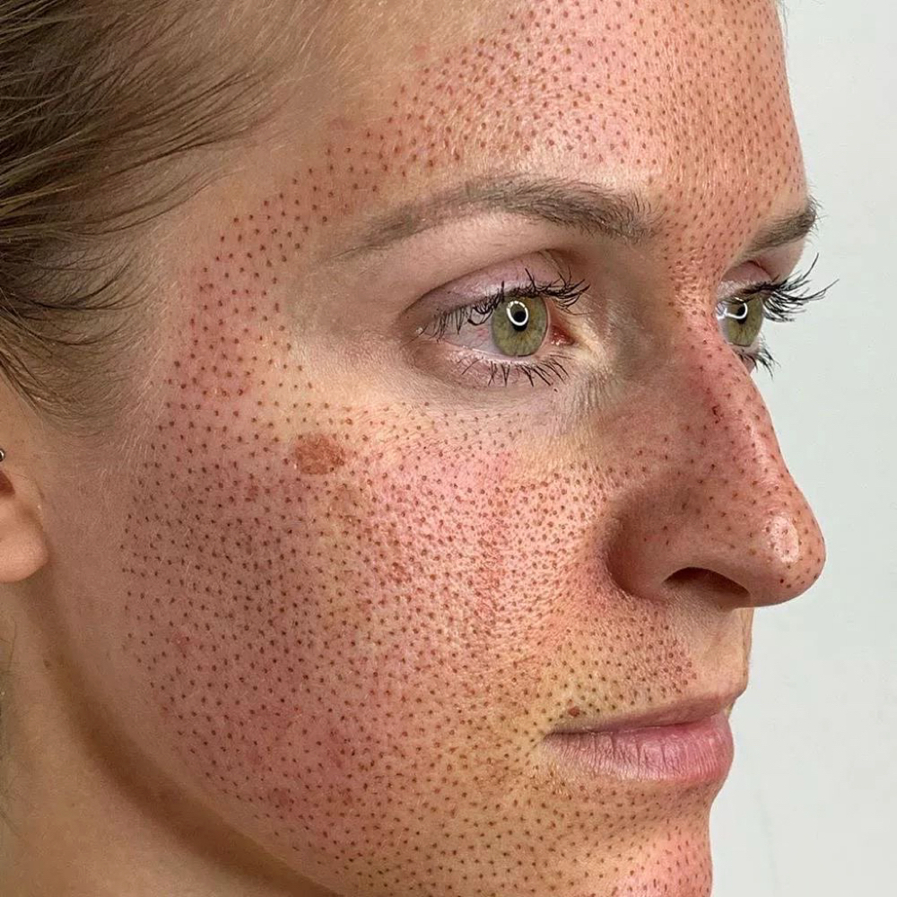 PLASMA FULL FACE