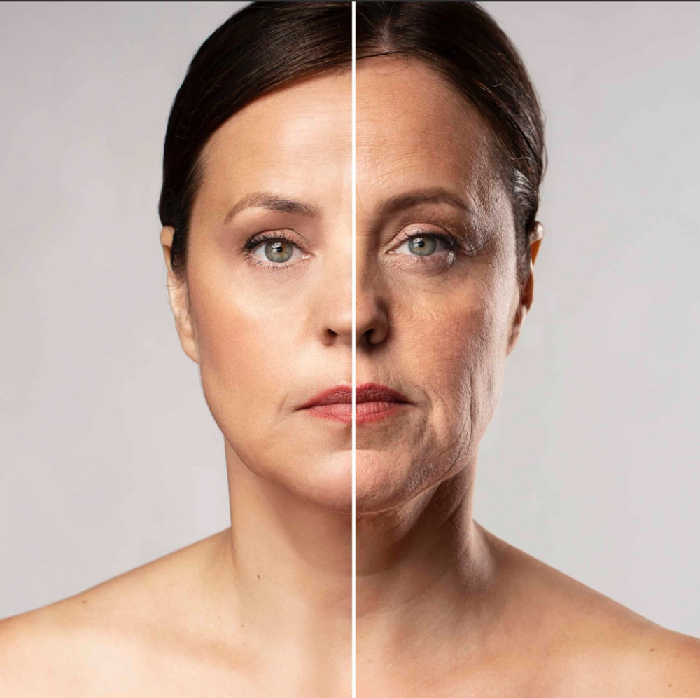 🟥2026 HIFU 36D Skin Tightening