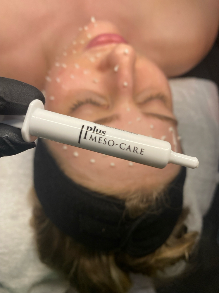 CELLSTORY “Liquid Microneedling”