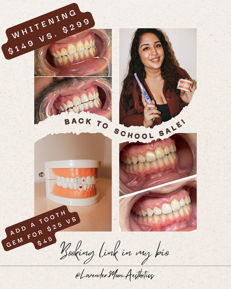 Back To School Teeth Whitening Sale