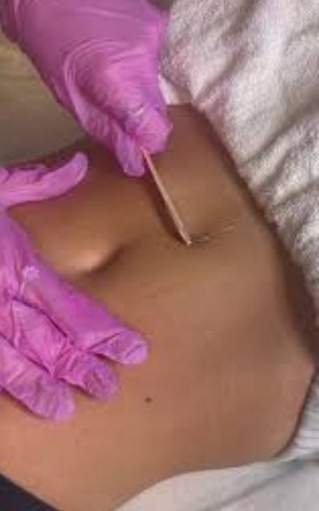 Stomach Strip