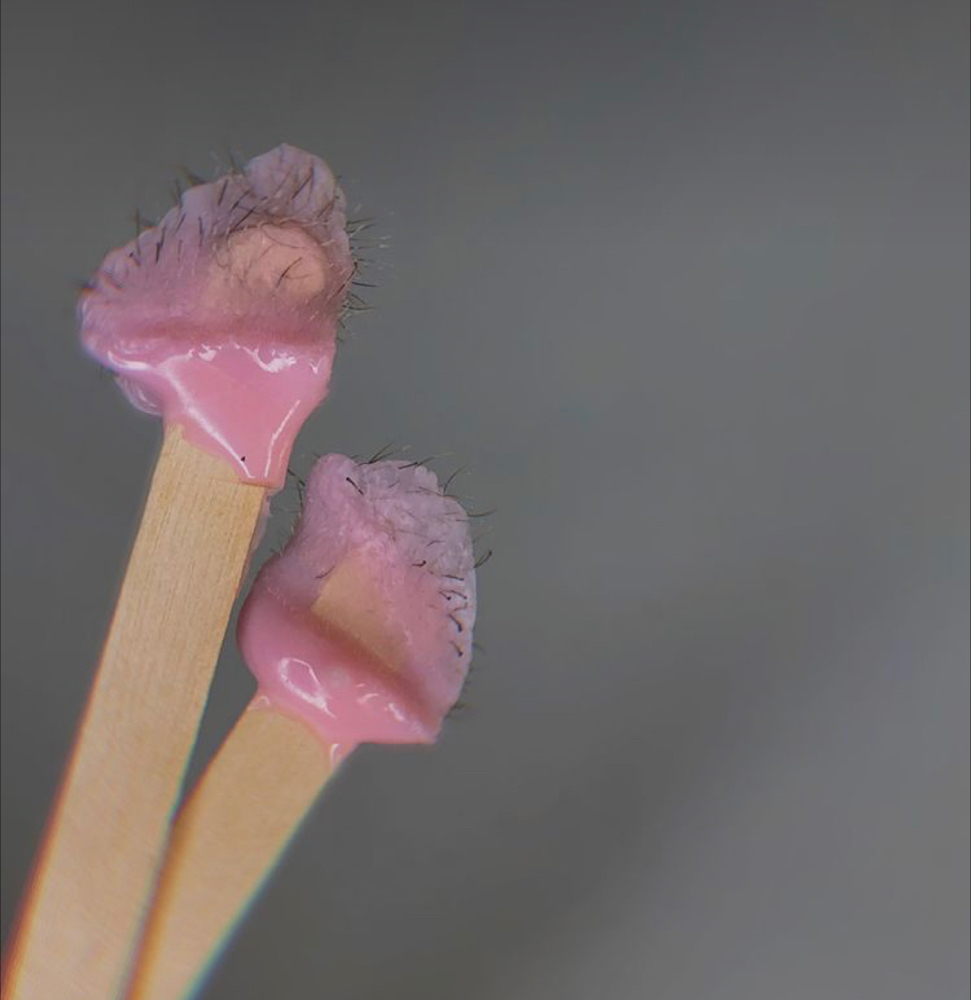 NOSE HAIRS