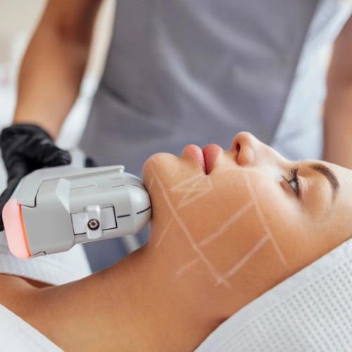 HIFU FACIAL at Star Spa Lash & Brow By: Evelyn Esthetician in Oakland, NJ
