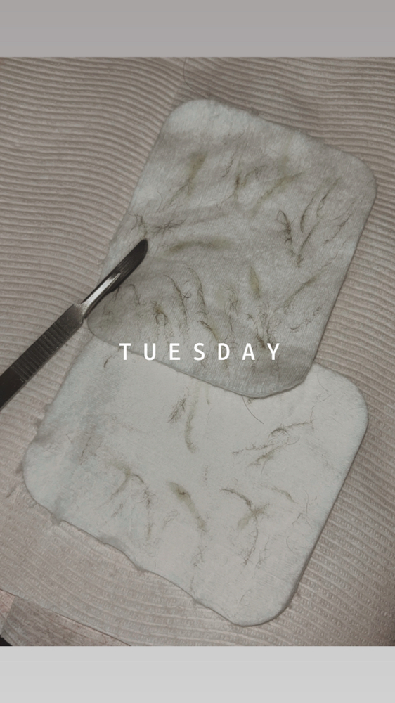 Dermaplaning