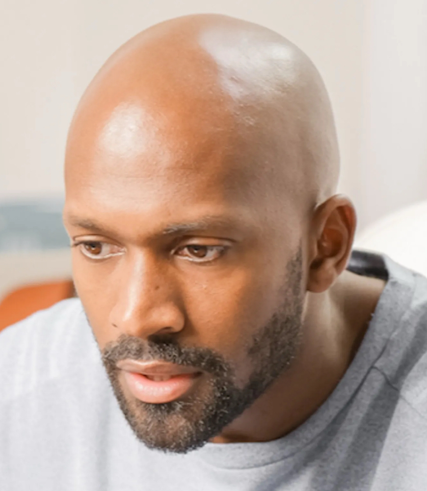 Bald Head Scalp Facial