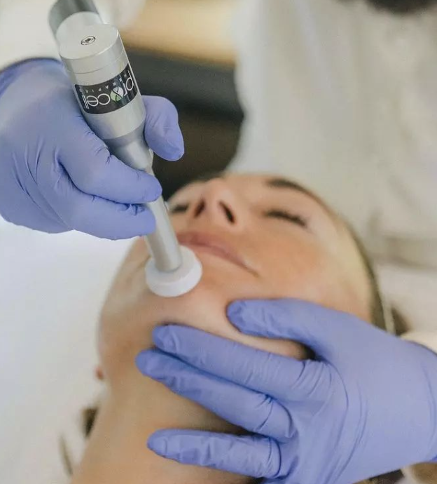 Procell Microchanneling (Face)