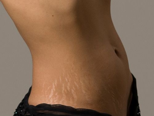 Full Stomach Wax at Glow With Juliana in Red Bluff, CA