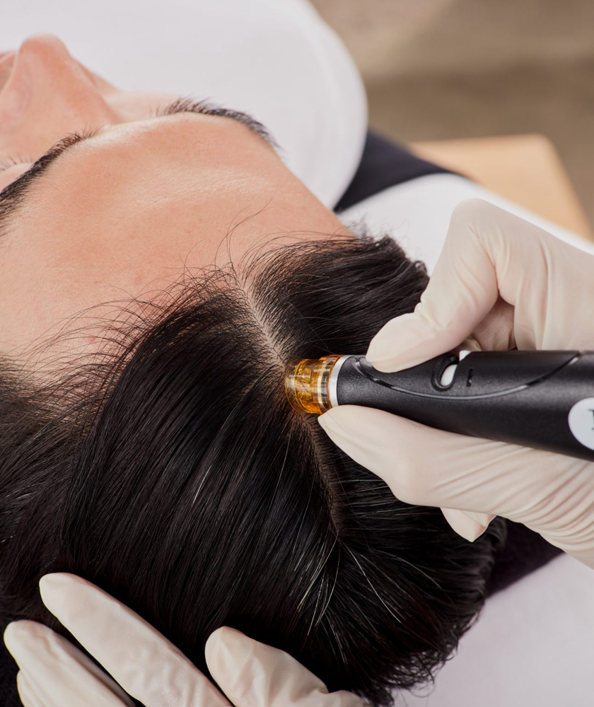 Hydroderm Scalp Treatment