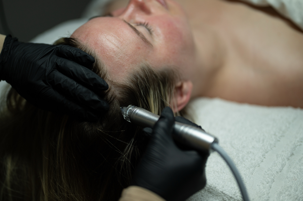 Hydroderm Scalp Treatment