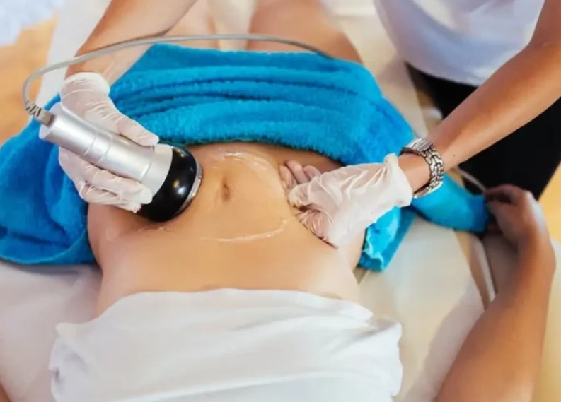 Ultrasonic Cavitation & Fat Burner