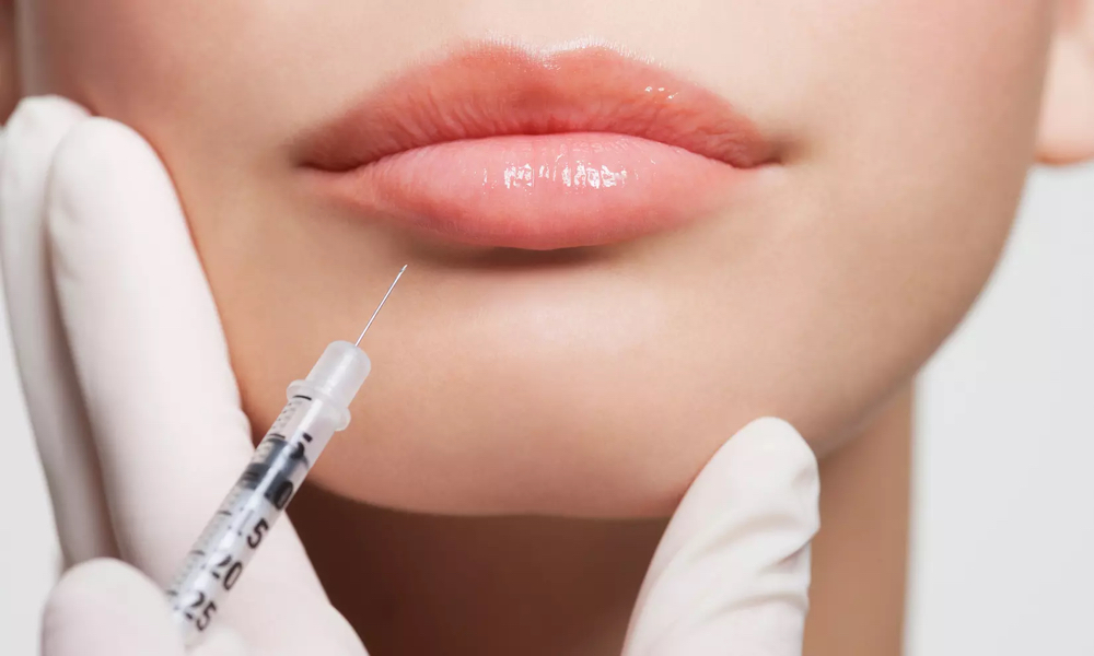 Lip Injections- Mini Lip