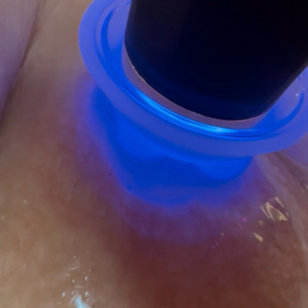 The Luxe Skin Brazilian at WaxWithAdri in Ontario, CA